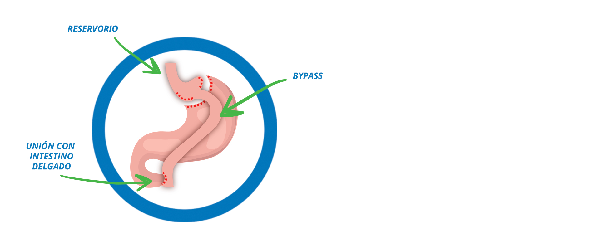 Slider Bypass